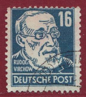 SBZ Nr. 218a PF F12 (V) Große Beule auf Kopf !!!RRR